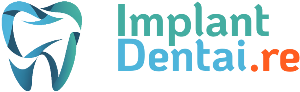 Implant Dentaire